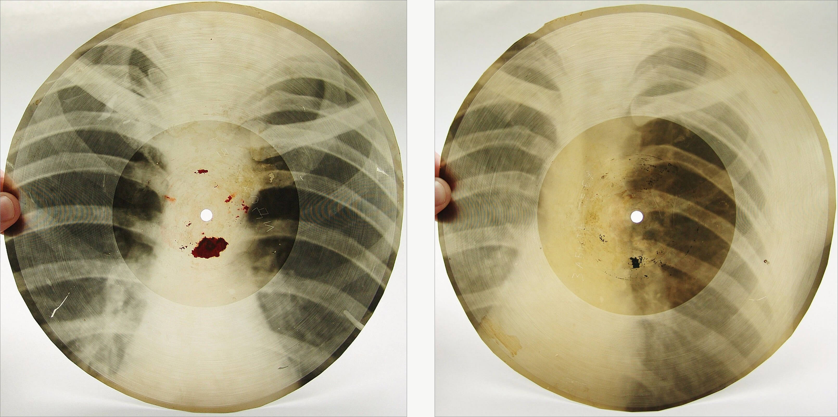 X-RayRecord-eBay.jpg